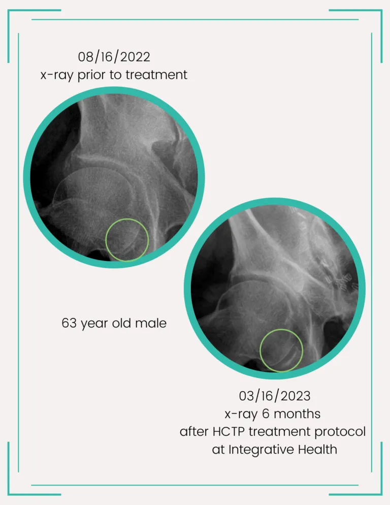 before and after xrays