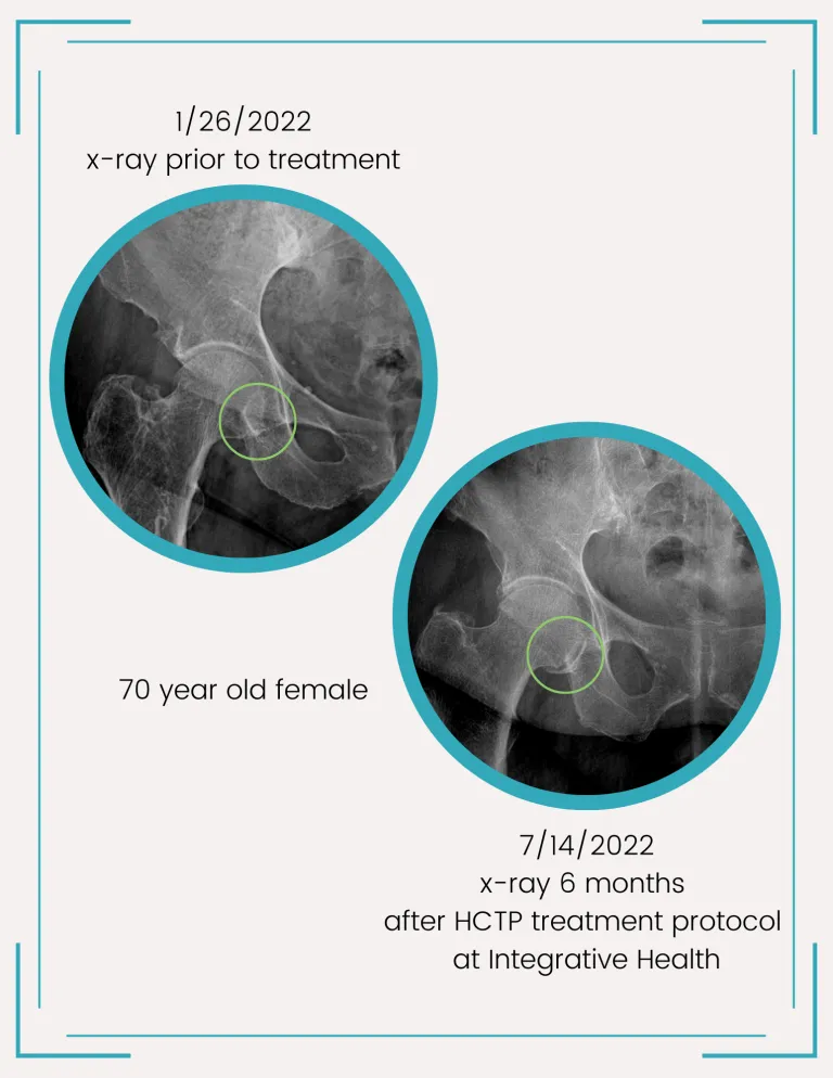 before and after xrays